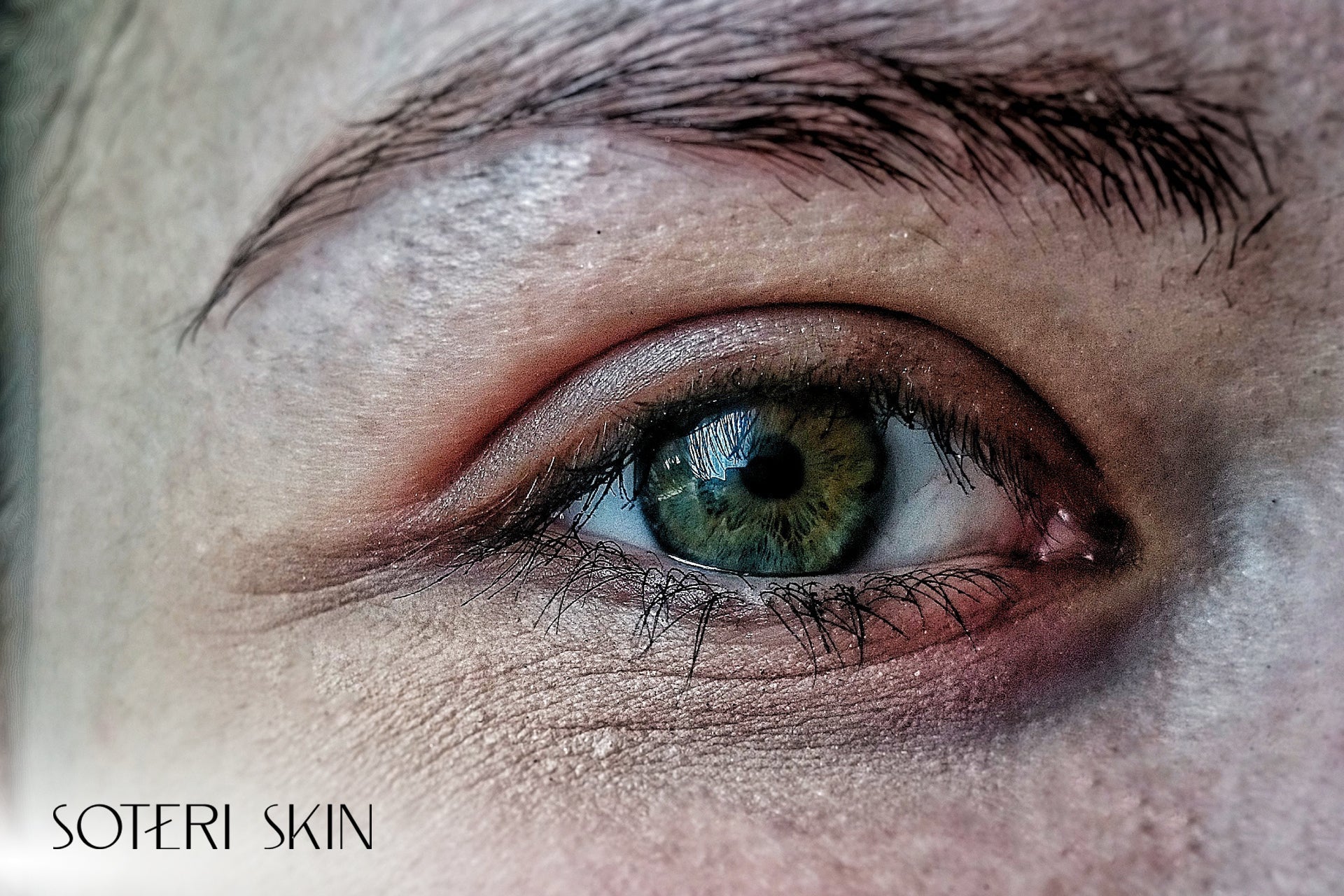 Understanding Eye Eczema and Its Causes, Symptoms, and Treatment Methods